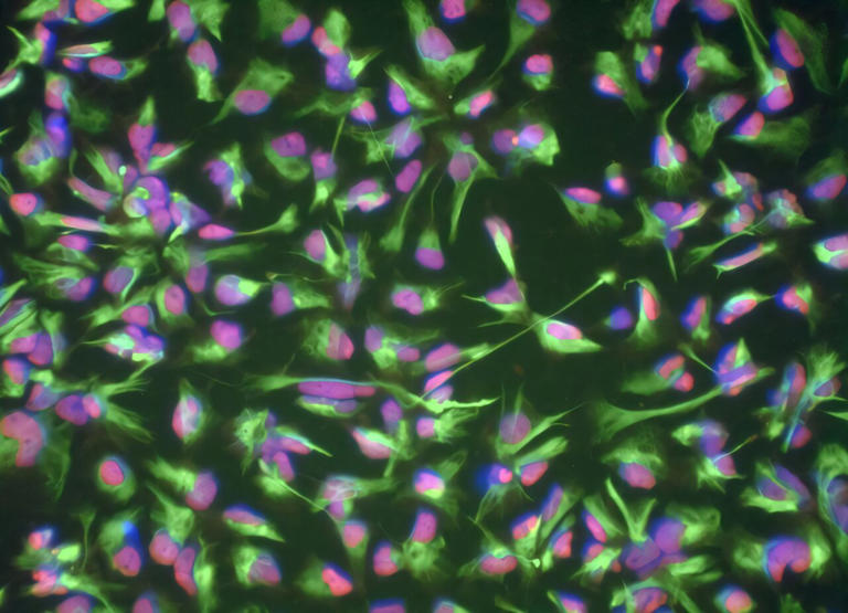 Blood cells from 80-year-old donor become stem cells with molecular age ...