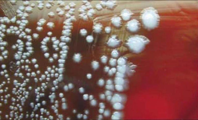 A Russian lab worker died after a possible plague exposure at a high ...