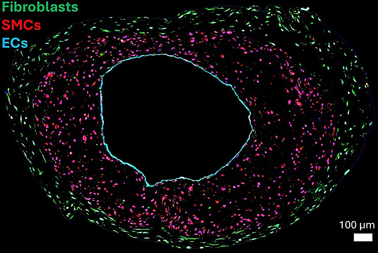 Lab-grown blood vessels reveal roles of different cells in rapid-aging ...