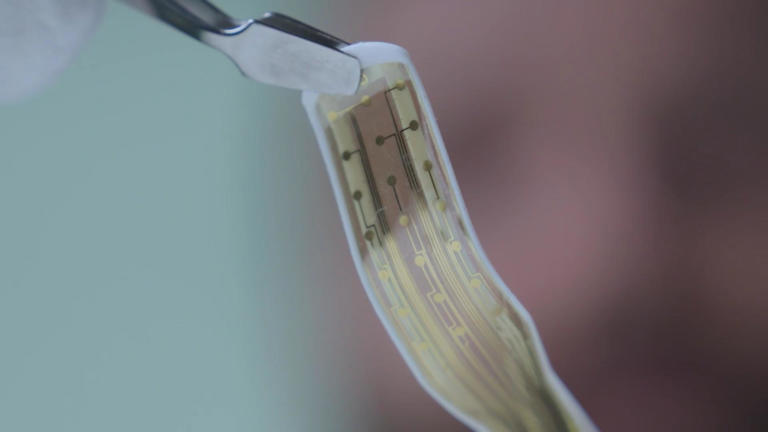 Graphene brain implant robot follows curves to targets conventional DBS ...