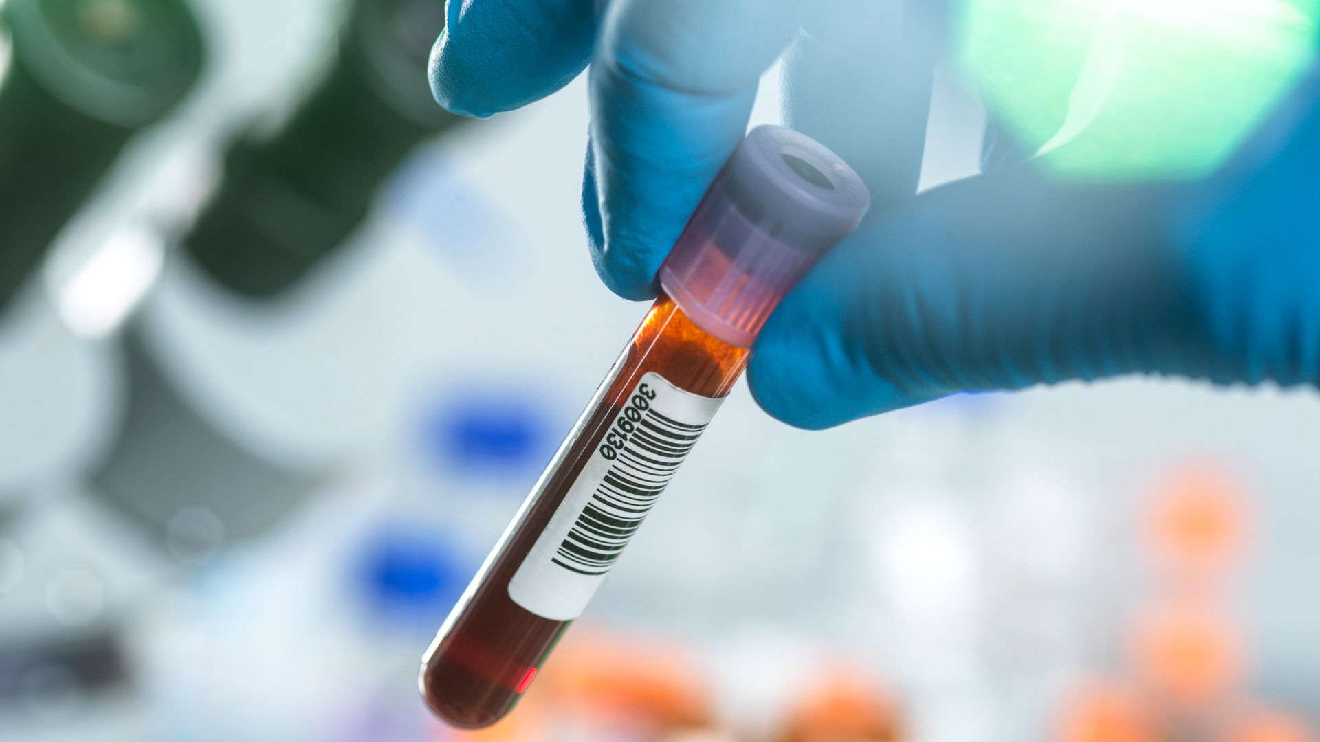 Scientists have identified a 'protein signature' in blood that could ...