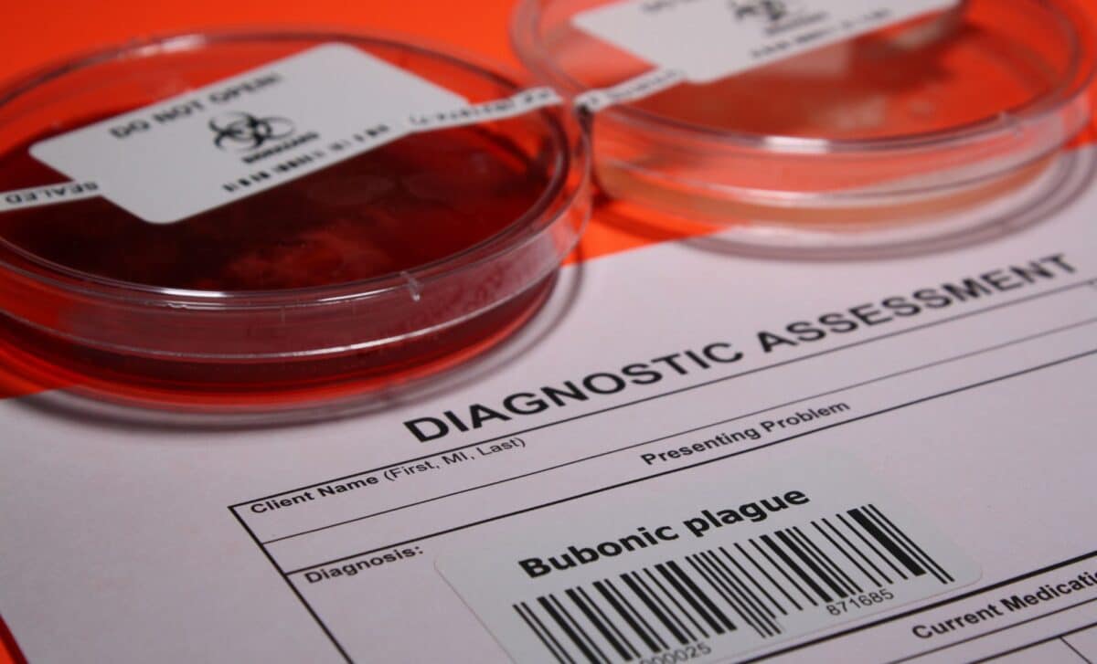 A Russian lab worker died after a possible plague exposure at a high ...