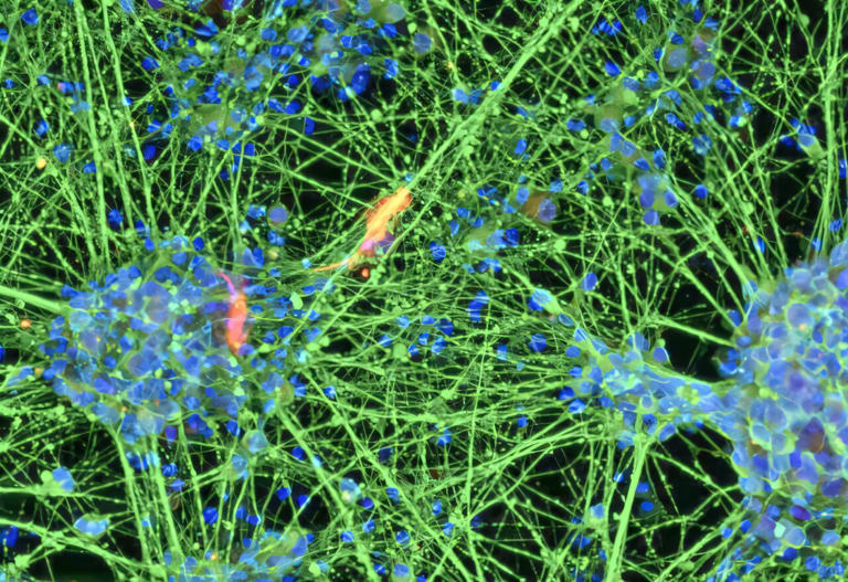 Blood cells from 80-year-old donor become stem cells with molecular age ...