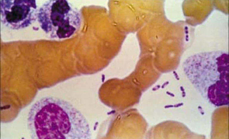 A Russian lab worker died after a possible plague exposure at a high ...
