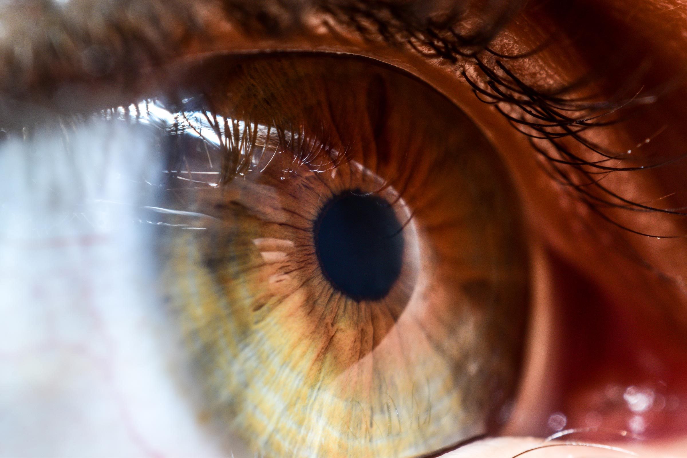 A routine eye scan could reveal a hidden heart problem, new study finds