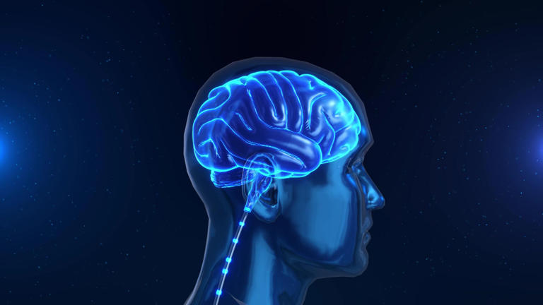 Brain freeze has nothing to do with your brain getting cold, and the ...