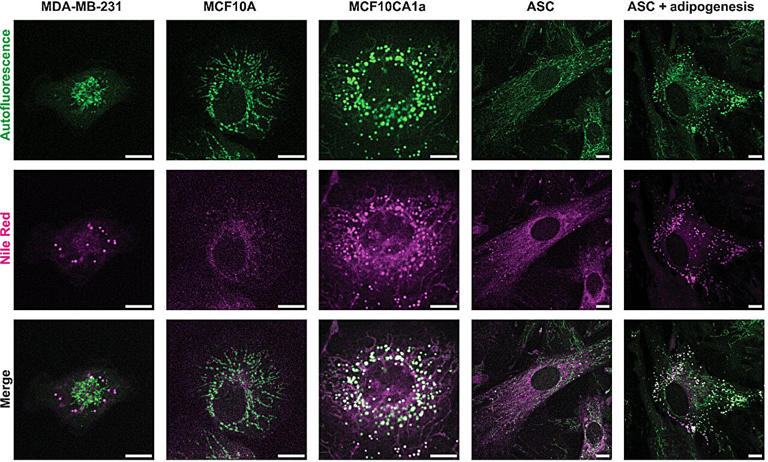 Fluorescent imaging tracks metabolism of cells in real time