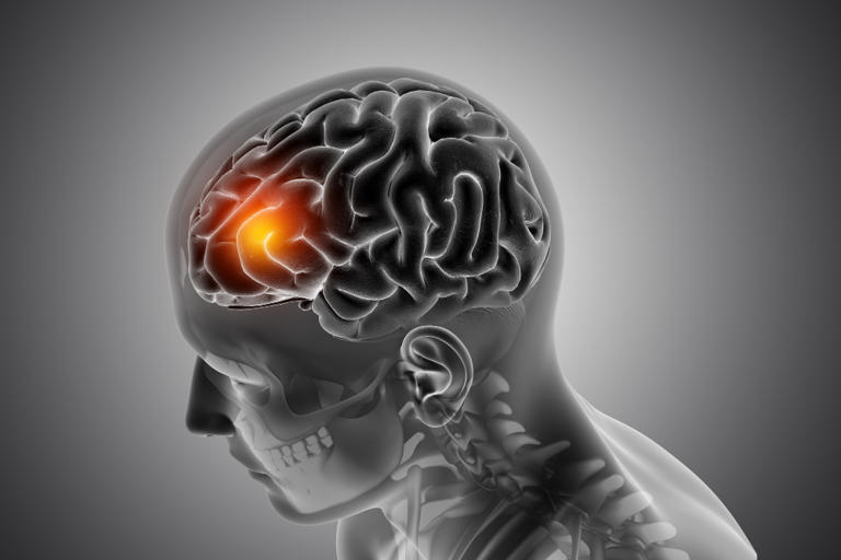 Brain freeze has nothing to do with your brain getting cold, and the ...