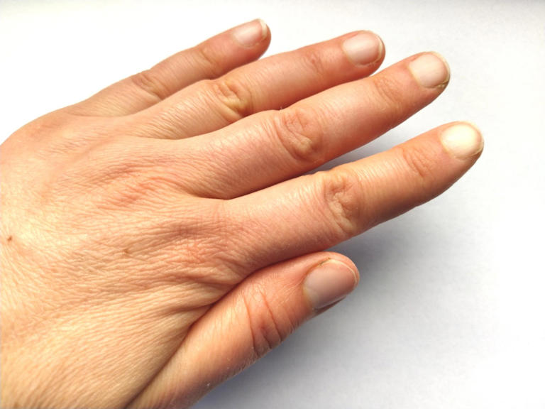 The crack of a knuckle is a bubble forming, not popping, and that is ...