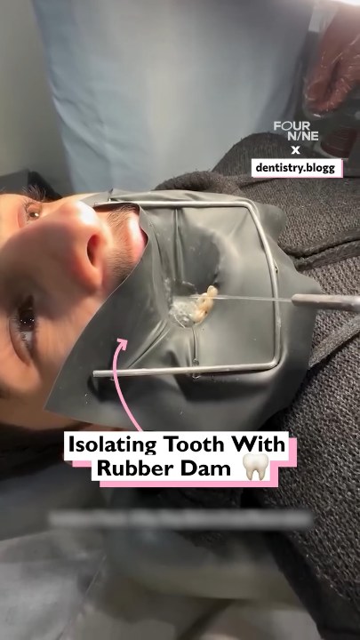 Bizarre technique for checking teeth