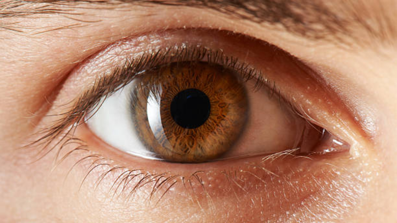 Eye symptoms people often dismiss: Doctors explain when headaches ...