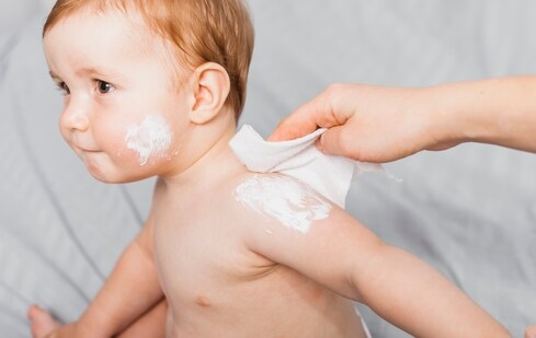 Skin rashes in children: Paediatrician explains common causes, warning ...