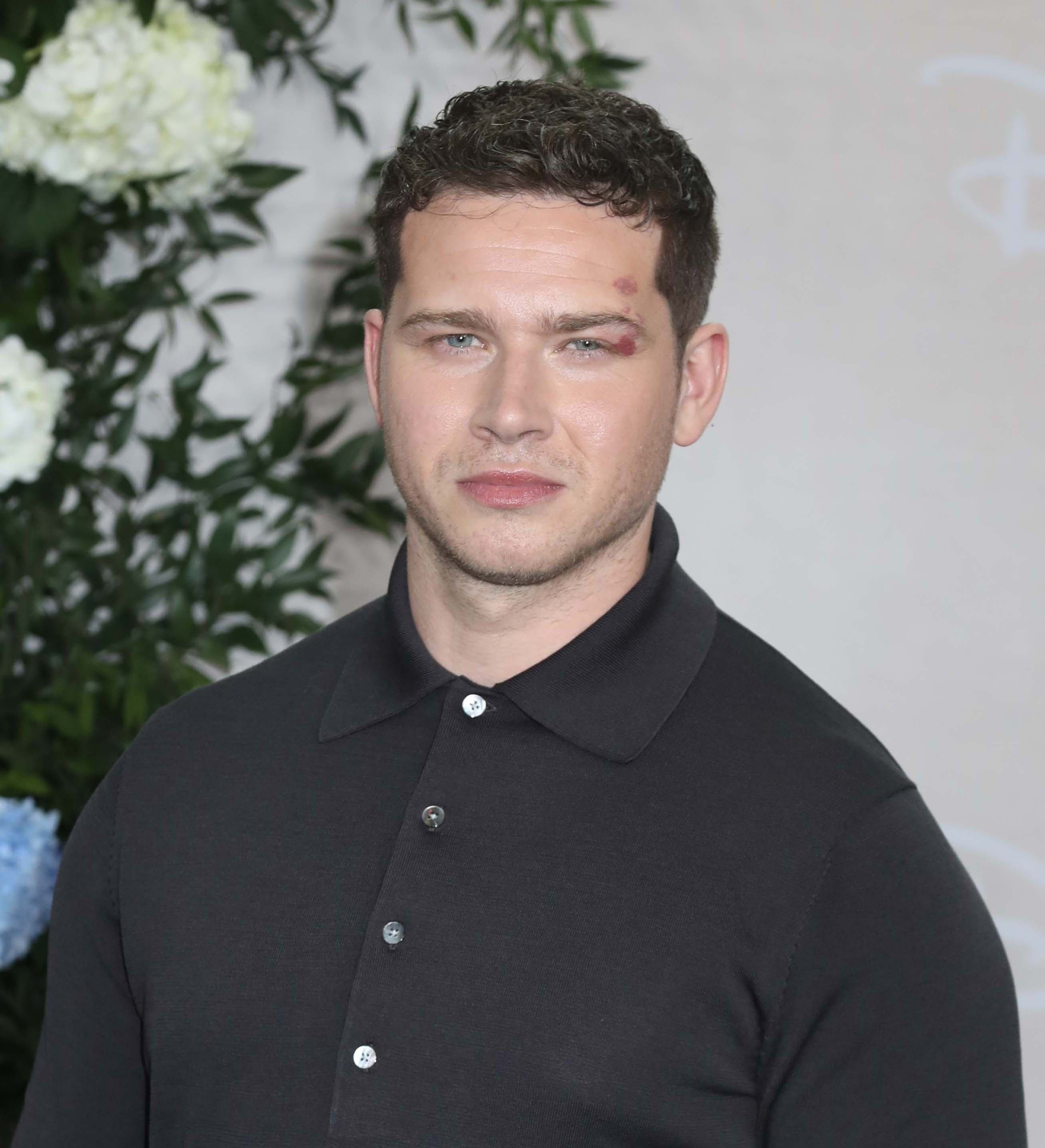 9-1-1 star Oliver Stark and 3 others suffer stunt-related injuries on set