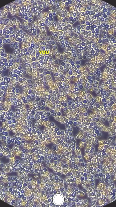 Amazing blood cell discoveries under a powerful microscope