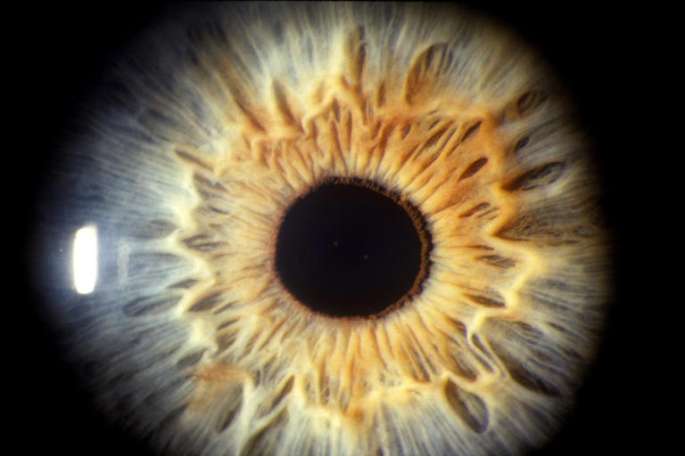 Woman goes for routine eye test—gets terrifying result: 'Emergency room'
