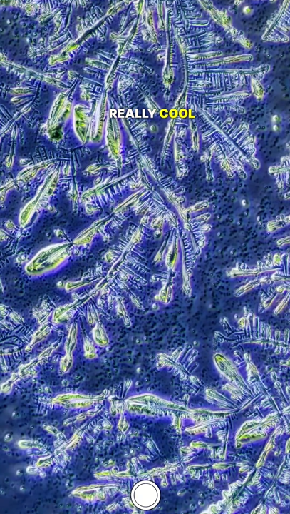 Amazing differences between tears under a microscope