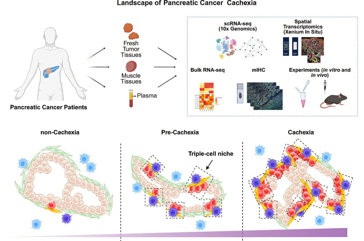 Cell network reveals how pancreatic cancer drives muscle and fat loss