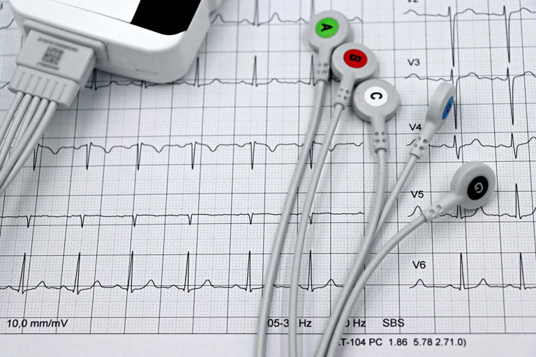 High-performance AI expands electrocardiogram analysis across medical tasks