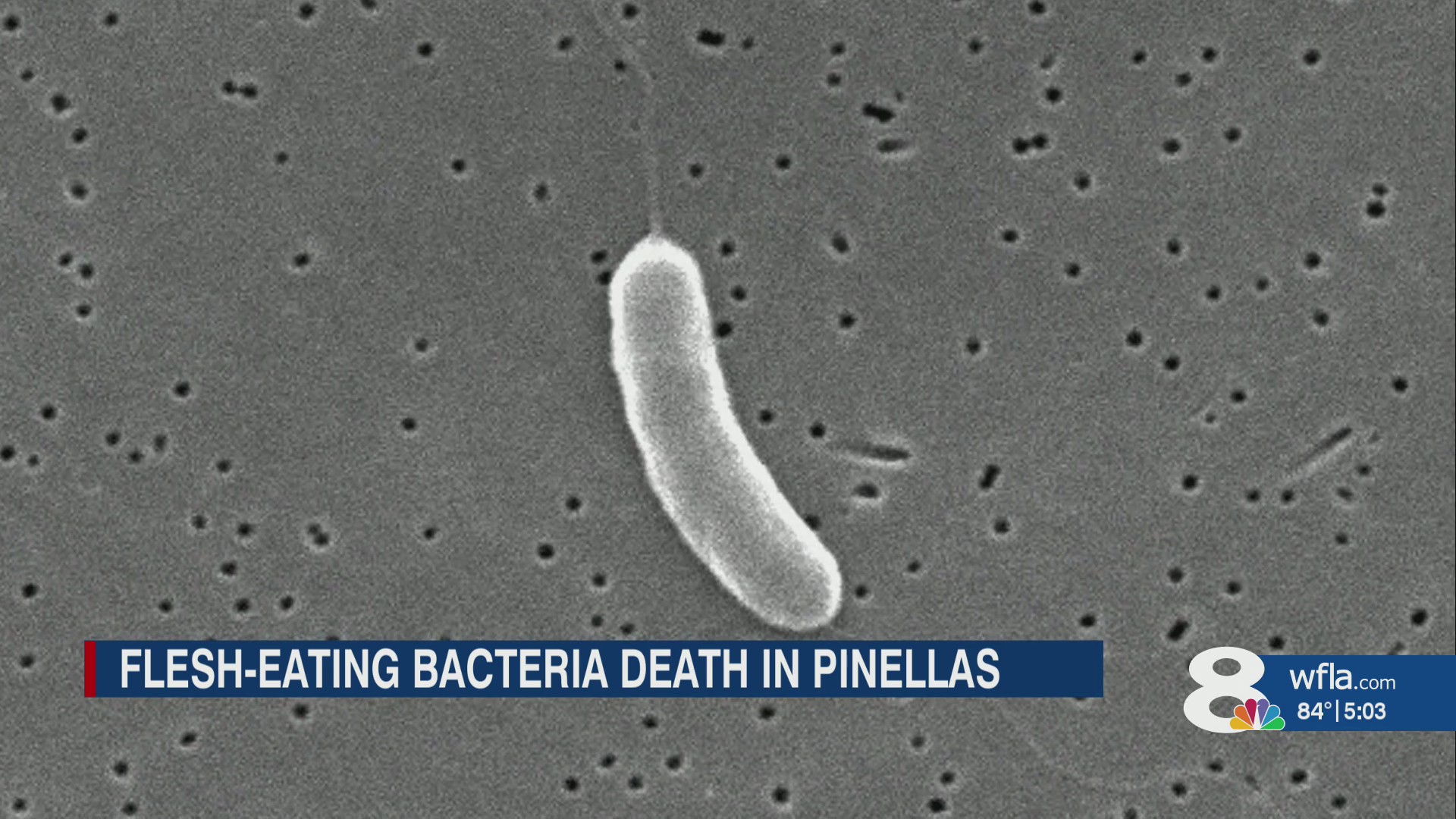Doctors send warnings about flesh-eating bacteria