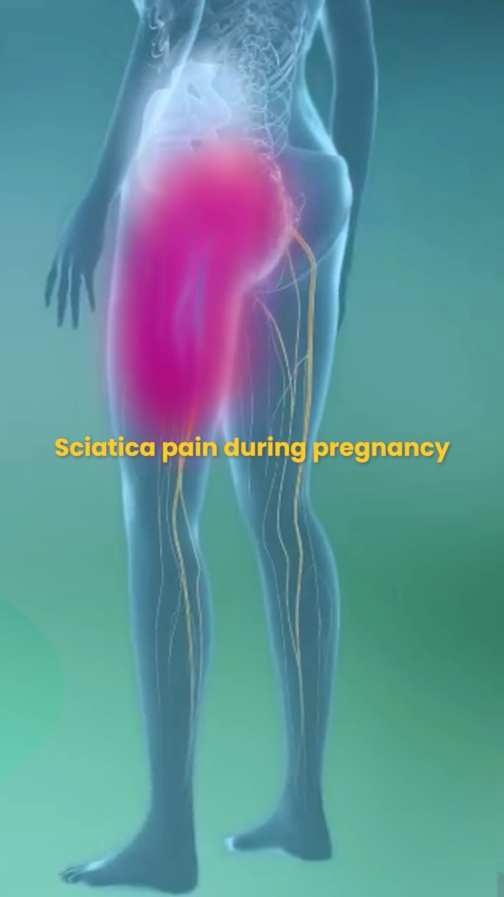 3 gentle stretches that may help ease sciatica discomfort