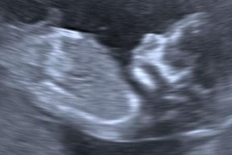 Woman offered termination after 20-week scan, stunned by what happens next