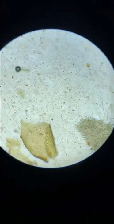 Amazing discoveries revealed under the microscope
