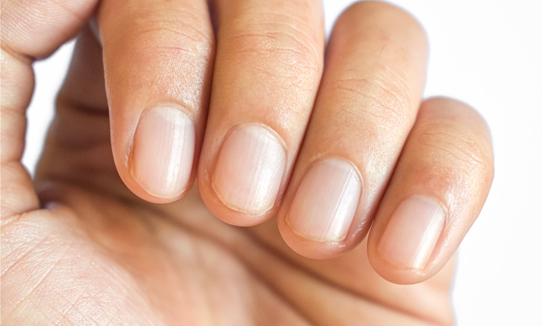 Warning over Ozempic nails - risk of fingernails falling off is four ...