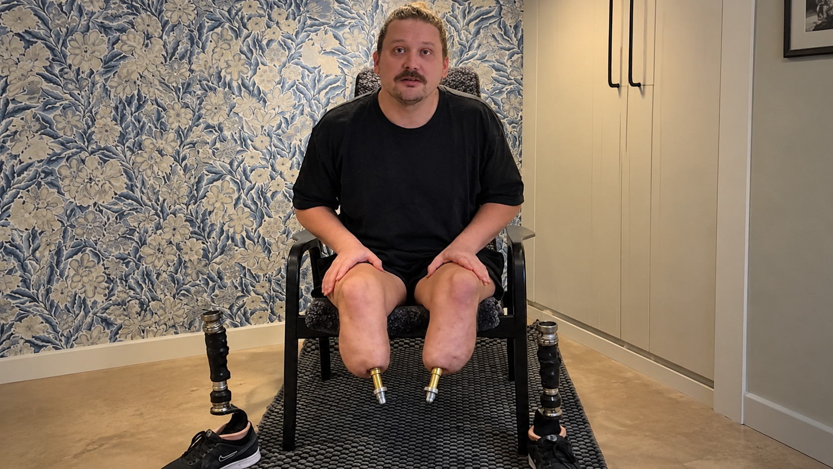 He was forced to remove his legs