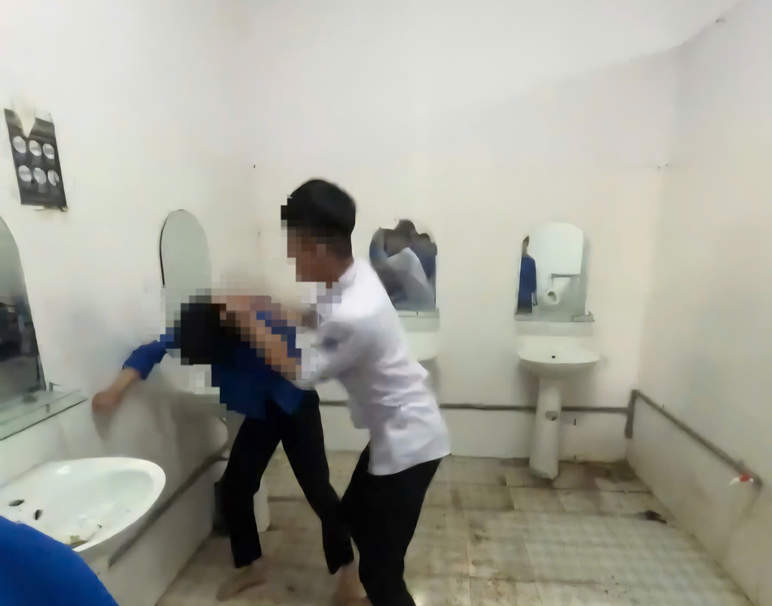 Nam sinh lớp 12 gãy xương mũi sau vụ xô xát tại trường học ở Lâm Đồng
