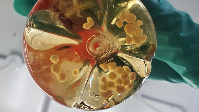 Scientists connected 3 human mini-brains in a dish. They learned ...