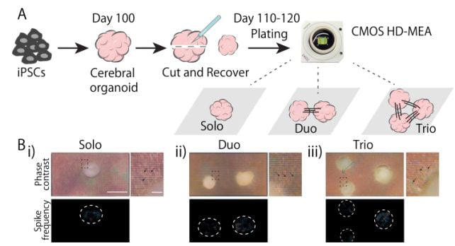 Scientists connected 3 human mini-brains in a dish. They learned ...