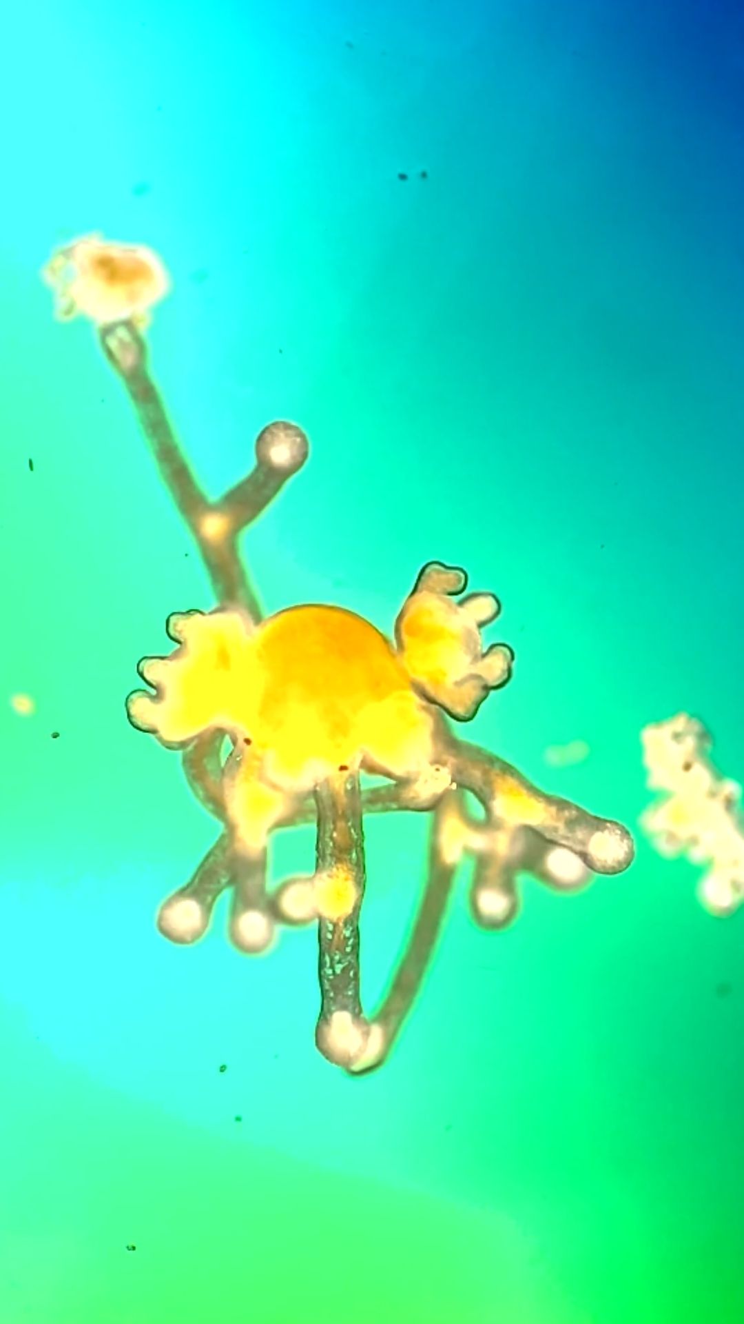 World’s smallest jellyfish under the microscope