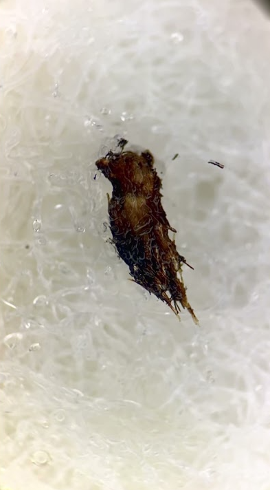 Used vape under the microscope reveals surprising details