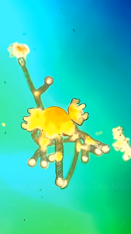 World’s smallest jellyfish under the microscope