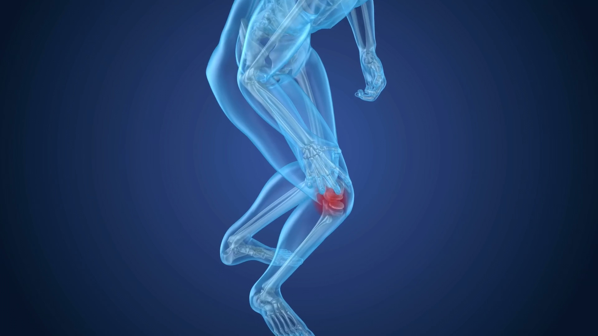 Orthopedic surgeons share six reasons you may not need a knee replacement
