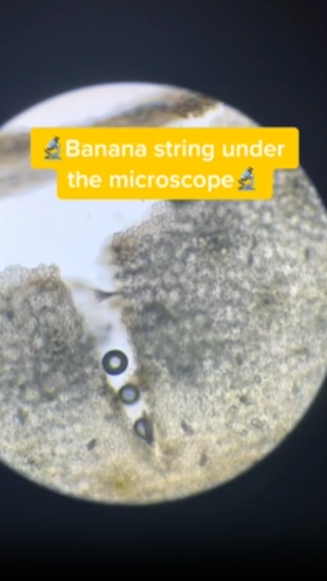 You've never seen a banana string this close before