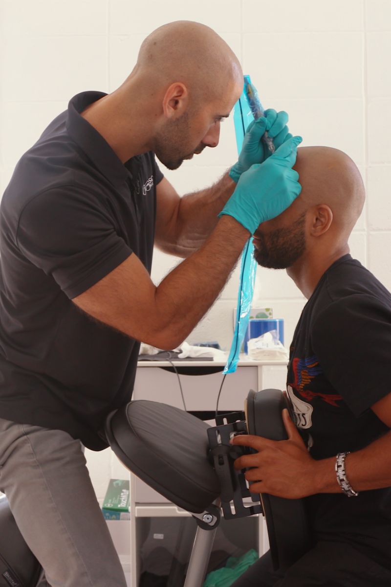 Matt Iulo devolve a confiança através da micropigmentação capilar
