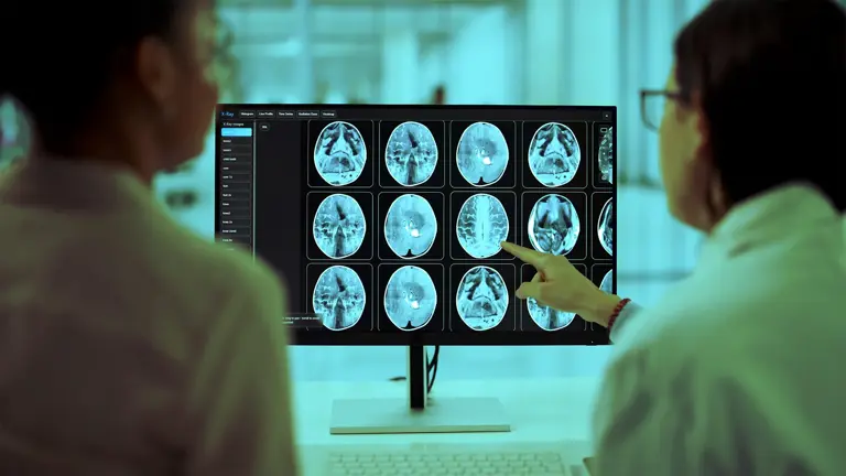A study of 52,198 people linked certain conditions to faster brain ...