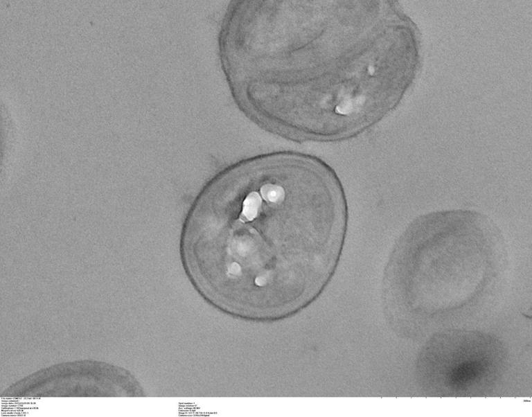 Growth in milk boosts Staph bacteria's resistance to antibiotics ...