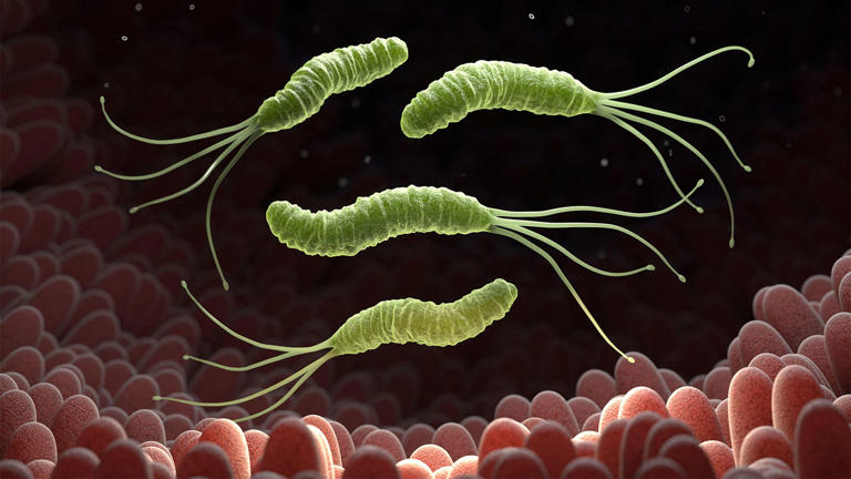 Millions of cancers linked to infections, study says