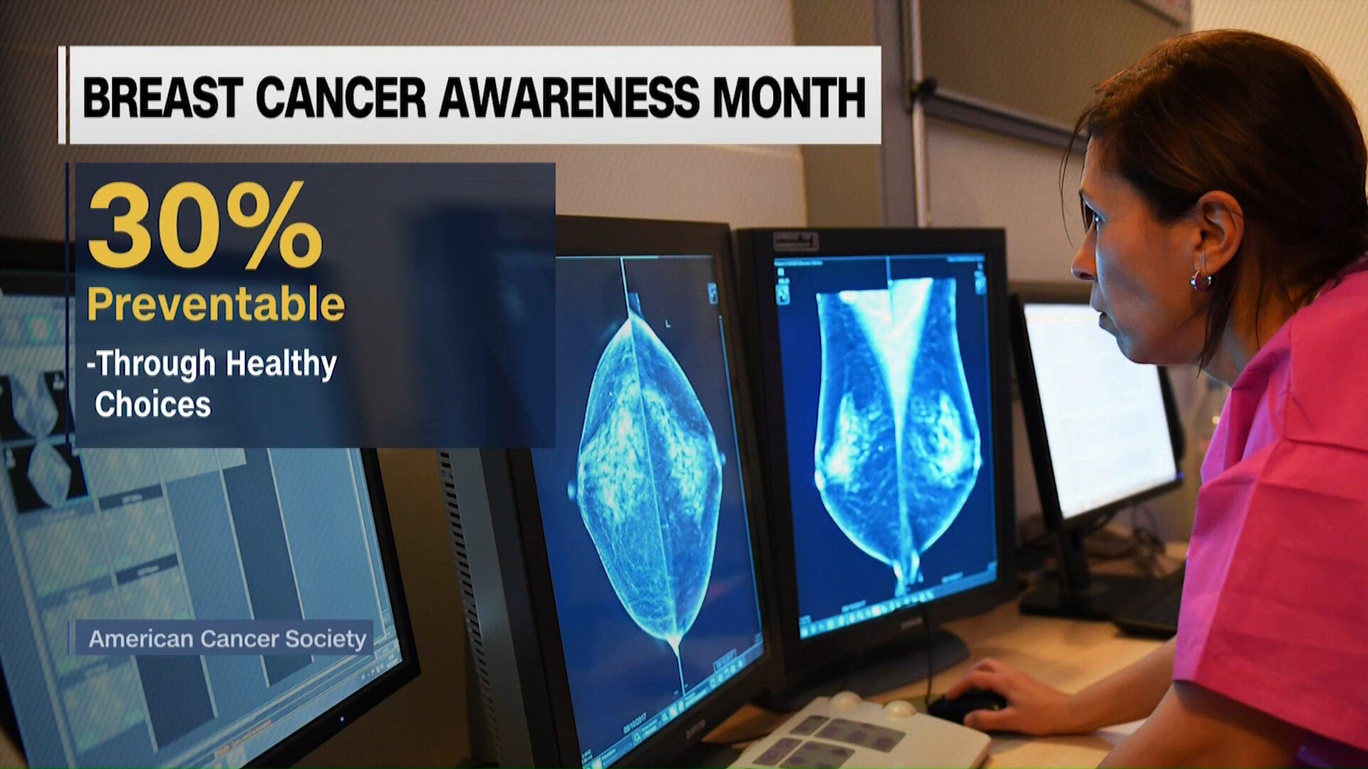 Healthy habits can help lower breast cancer risk, experts say