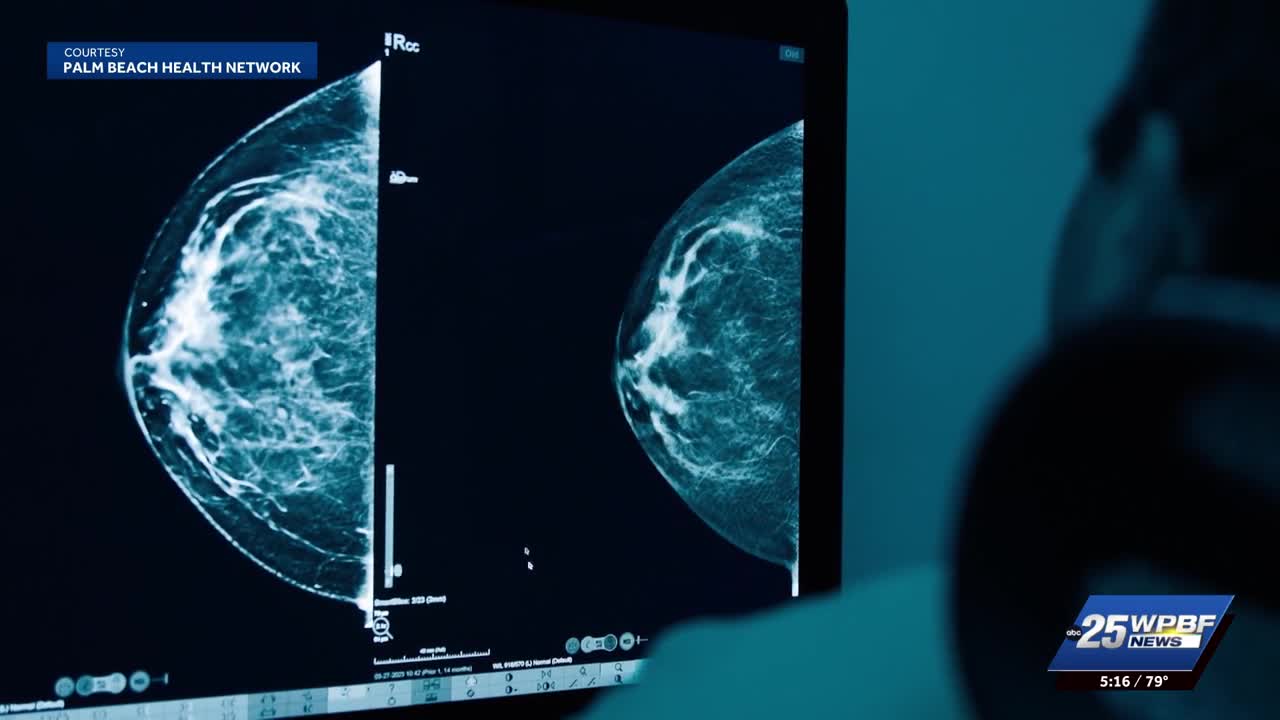 Screenings are key to early breast cancer detection and treatment