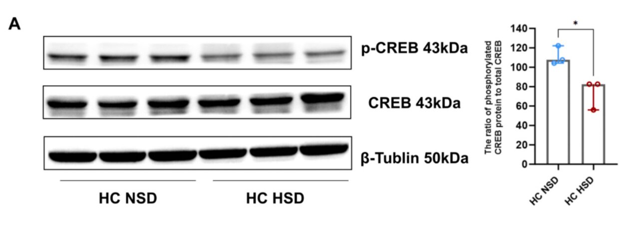 Too little salt may hurt memory just as badly as too much