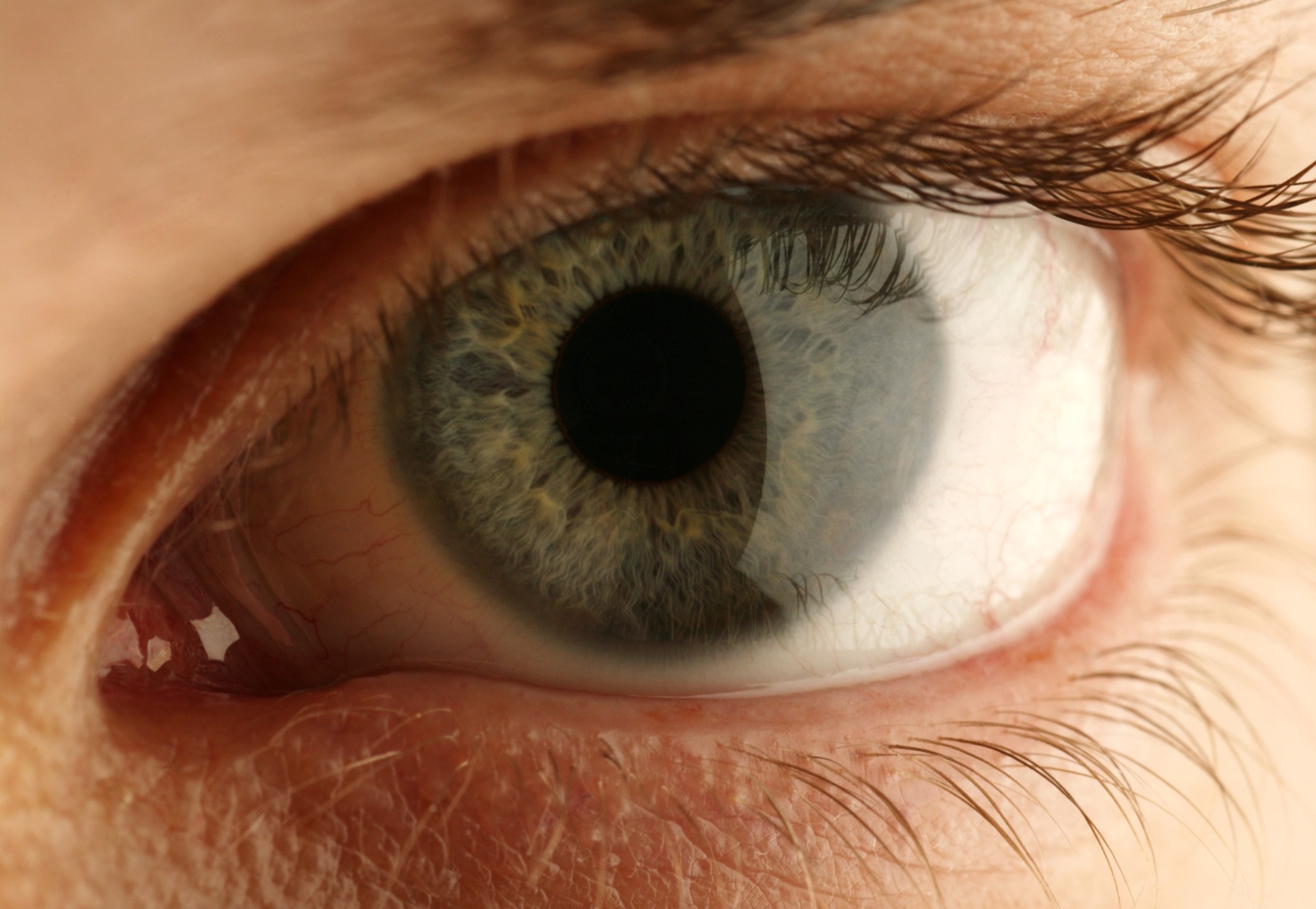 Contact lenses are changing because our lives are changing | Opinion