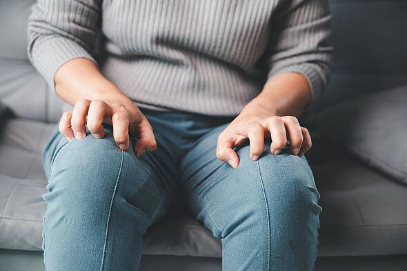 Brits with common skin condition may be eligible for £194.60 per week ...
