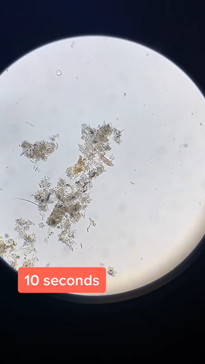 Microscope reveals a hidden world up close