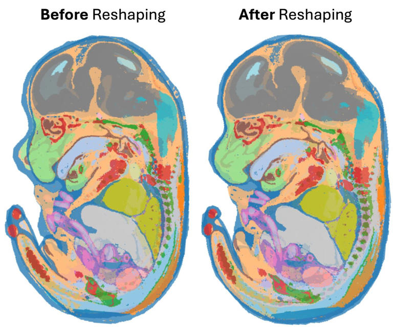 New algorithm makes maps of gene activity easier to compare while ...