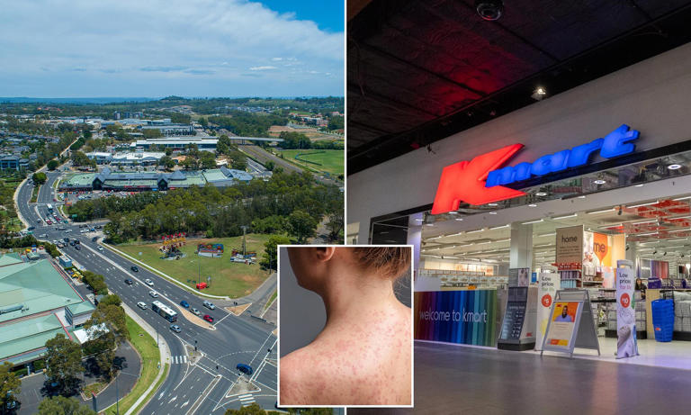 Urgent measles warning for Sydney after infected patient visits popular ...