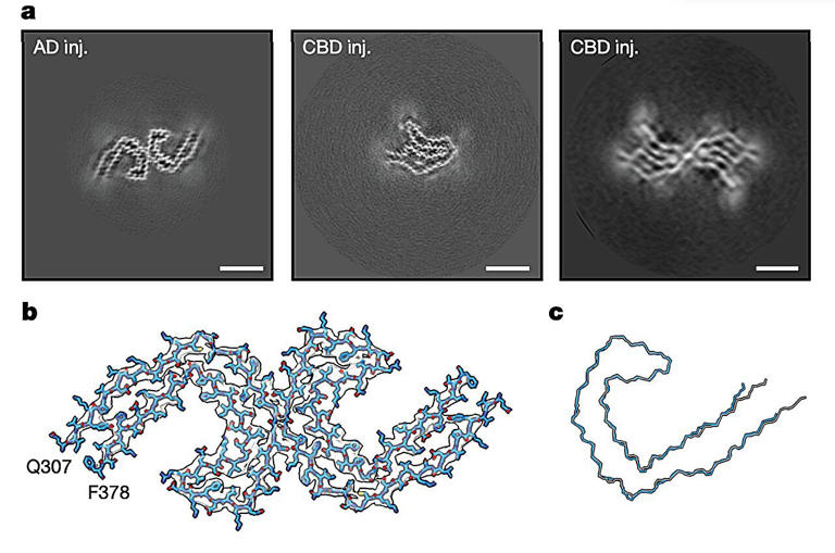 Human tau seeds trigger disease-specific shapes in mouse brains, new ...