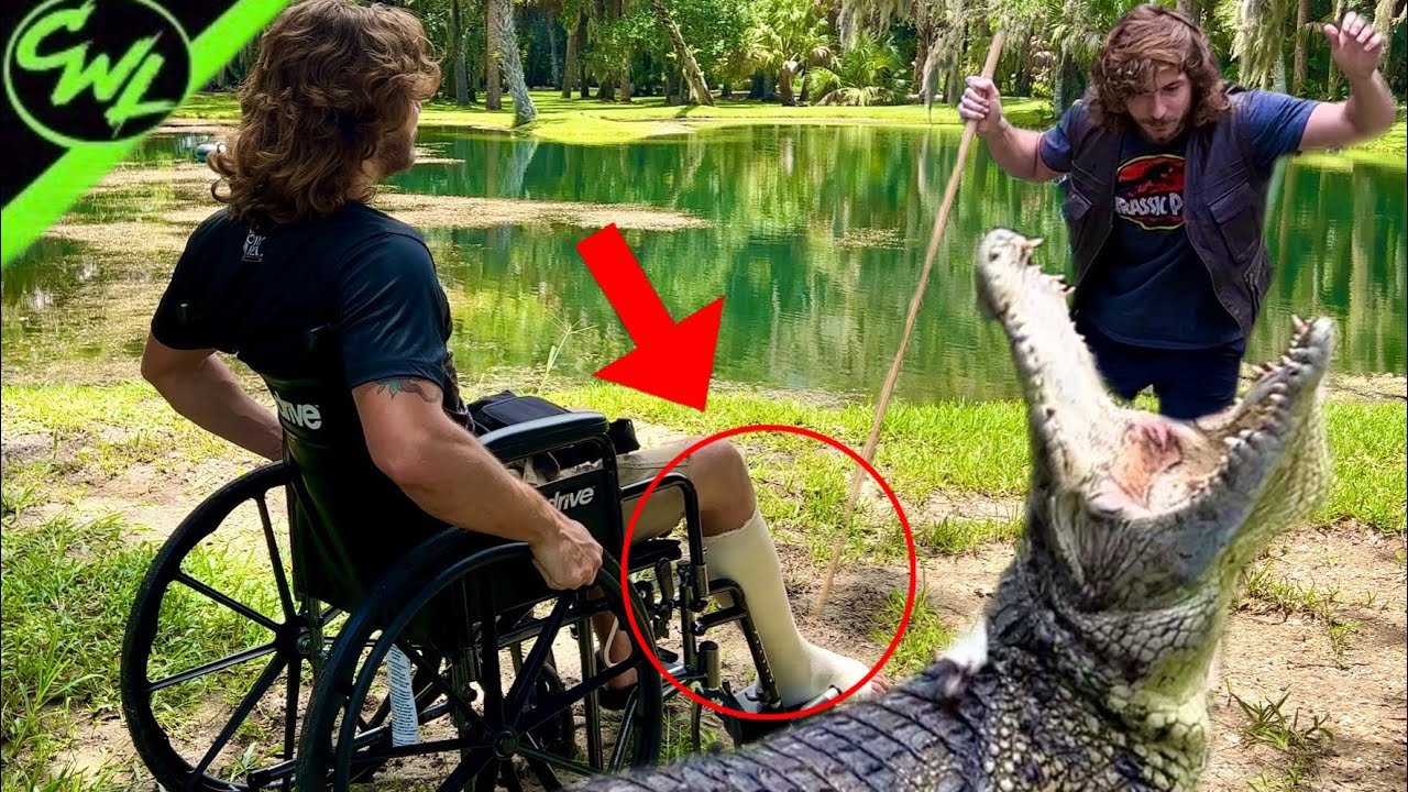 Crocodile bite leads to hospital visit